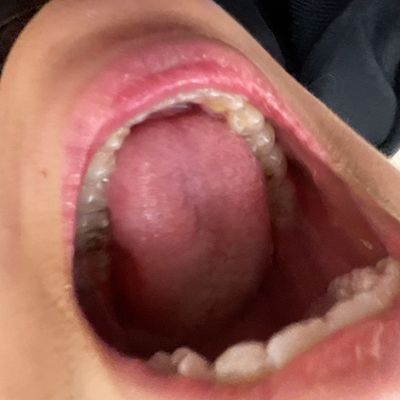 Player: shroomshroom